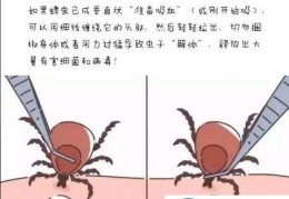 蜱虫怎么去除简单方法