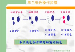 革兰染色的原理的三种说法(革兰染色的原理)