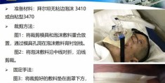 不同的应对压力：自残与创伤修复师Lucy的经历对比