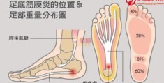 隐隐感觉足跟痛,时有时无,是怎么回事(左脚后跟痛是怎么回事)