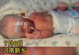 产妇生下龙凤四胞胎(三男一女四个宝宝)