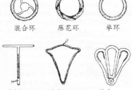 避孕环、节育环、宫内节育器是个啥(避孕环是什么原理)